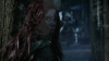 the_100_survivors_1802.jpg