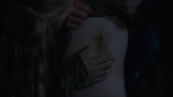 The 100 Season One Episode Nine Unity Day-581
