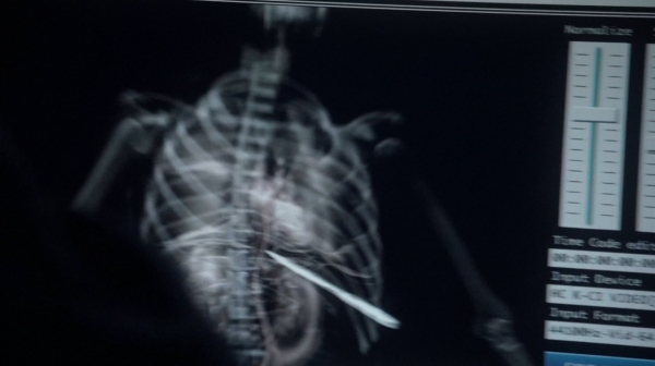 The 100 Season One Episode Seven Contents Under Pressure-1045
